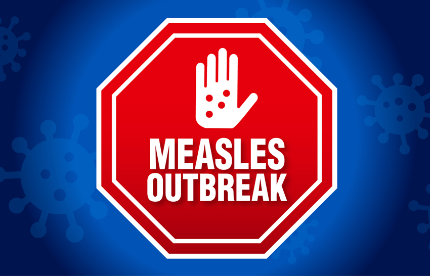 measles outbreak