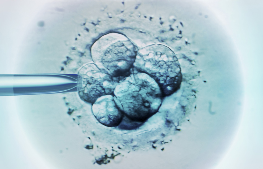 Embryo Selection for IVF light Micrograph 
