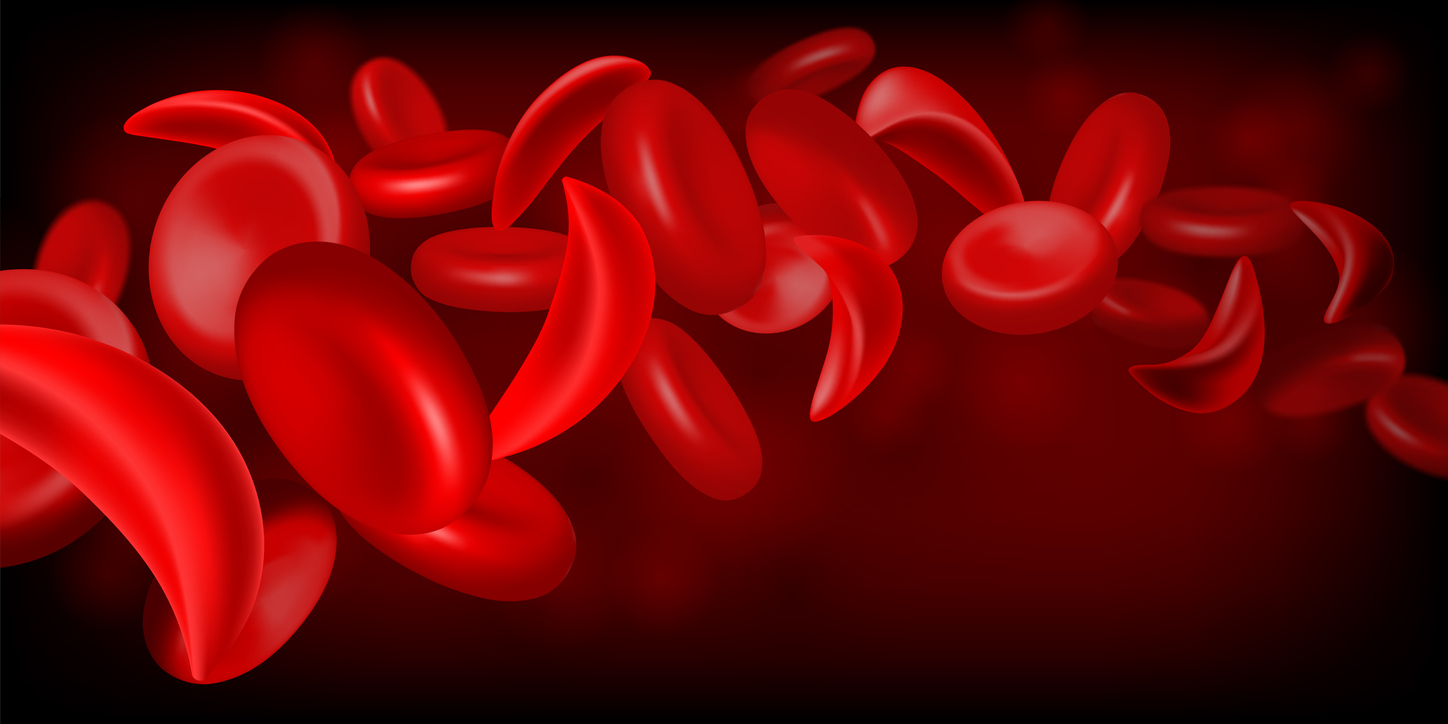 normal red blood cell and sickle cell flow inside in artery