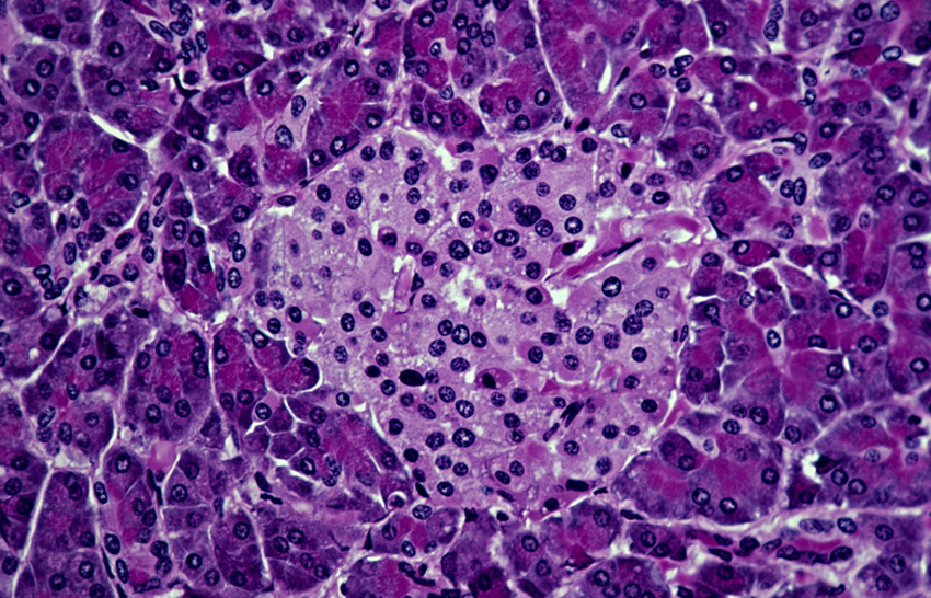 endocrine tissue (light, pink tissue) consisting of islet cells (alpha and beta cells), and exocrine tissue (surrounding, dark tissue). Beta cells secrete insuline and the alpha cells secrete glucagon.