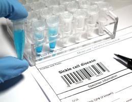 Test tubes and gloved hand