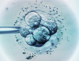 Embryo Selection for IVF light Micrograph 