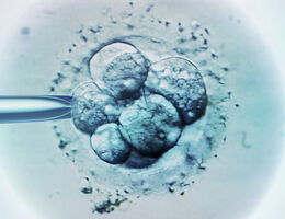 Embryo Selection for IVF light Micrograph 