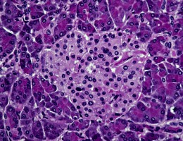 endocrine tissue (light, pink tissue) consisting of islet cells (alpha and beta cells), and exocrine tissue (surrounding, dark tissue). Beta cells secrete insuline and the alpha cells secrete glucagon.